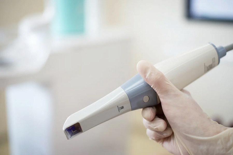 Интраоральный стоматологический 3D сканер Alliedstar AS 100 Pictures - Фото 10