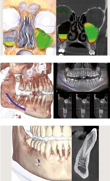 Дентальный томограф Castellini X-RADIUS COMPACT 3D/2D (10x10) - Фото 4